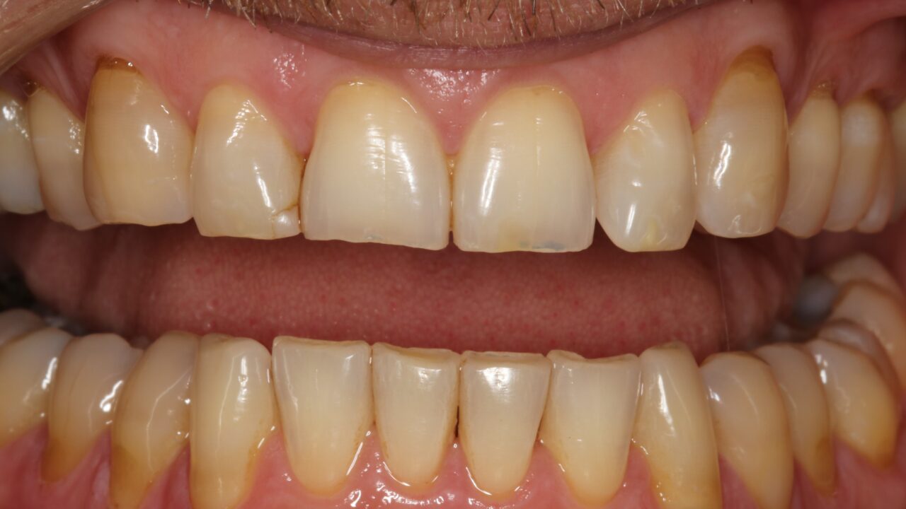 Smile Gallery | Brodie Dental