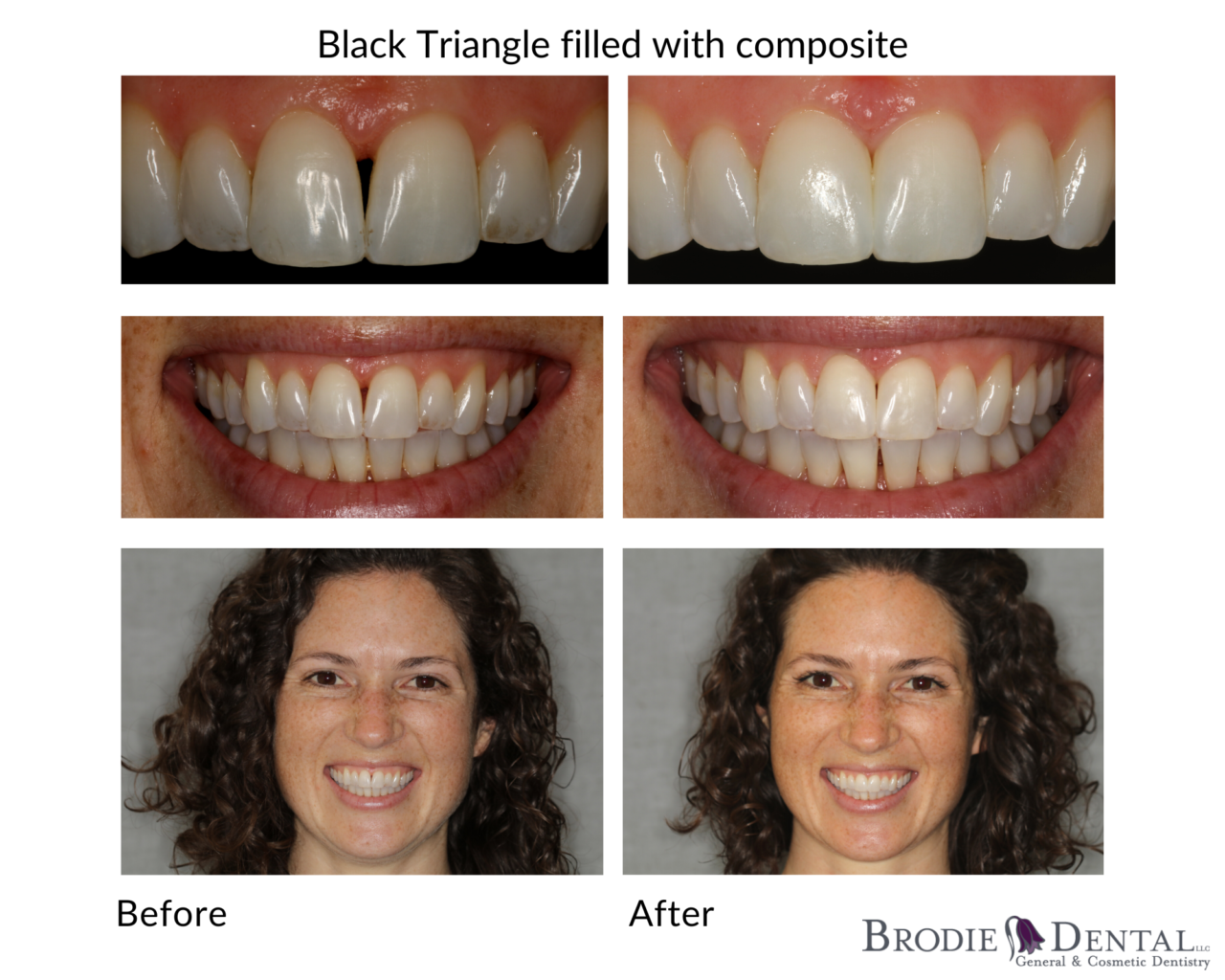 Smile Gallery | Brodie Dental